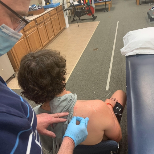 dry-needling-Rehab-Advantage-and-Sports-Medicine-Dublin-Sandersville-Metter-GA